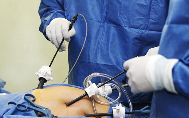 Precio cirugía de vesícula