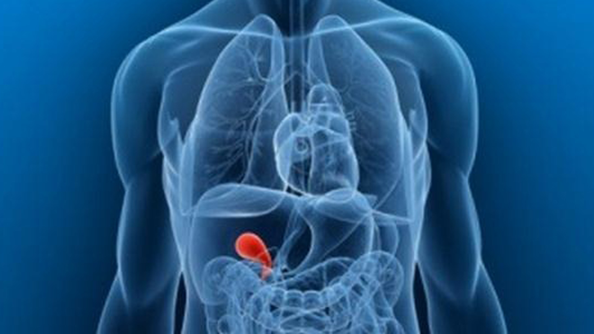 Precio operación de urgencia de vesícula